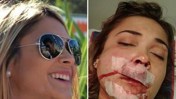 esta es la joven brutalmente agredida por patovicas esta es la joven brutalmente agredida por patovicas