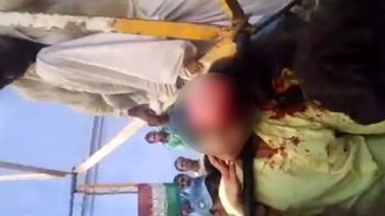 La adolescente perdió todo su pelo mientras se sacaba una selfie en un parque de atracciones. La adolescente perdió todo su pelo mientras se sacaba una selfie en un parque de atracciones.