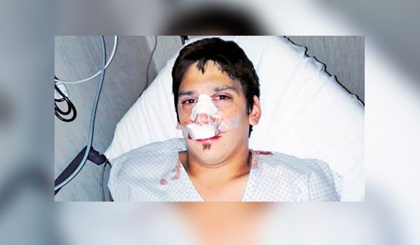 Ituzaingó: seis patovicas atacaron a un joven en un boliche