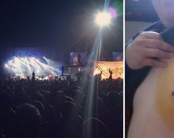 Un periodista denunció agresión policial en un recital de La Renga