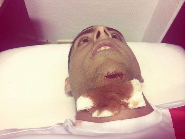 Así quedó Funes Mori tras el choque con su arquero: mirá la impresionante foto