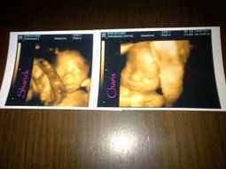 la primera imagen de las gemelas de cinthia fernandez la primera imagen de las gemelas de cinthia fernandez