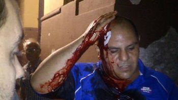 la policia volvio a la calle y reprimio a manifestantes la policia volvio a la calle y reprimio a manifestantes