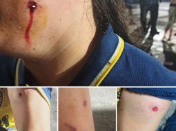 Así reprimió la Policía a los hinchas de Boca en La Plata