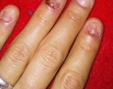 Tiene las manos así y pide ayuda por Facebook