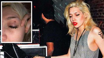 militta bora, nueva victima de violencia de genero: fue golpeada en un asado militta bora, nueva victima de violencia de genero: fue golpeada en un asado