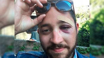 recibio una paliza por parecerse a un famoso actor de hollywood recibio una paliza por parecerse a un famoso actor de hollywood