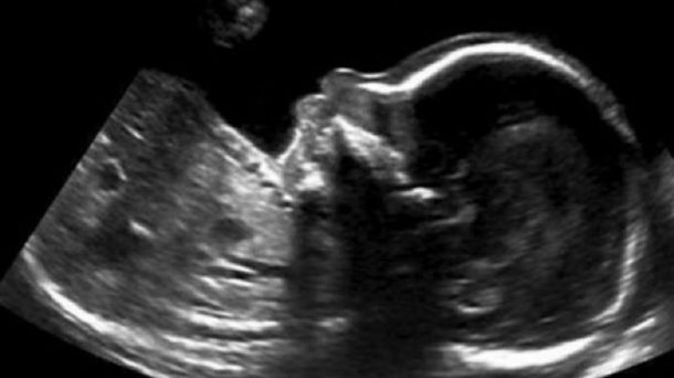 El tierno mensaje de un bebé desde la panza