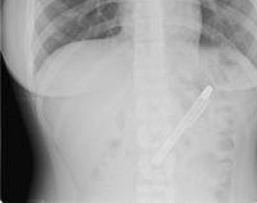 Insólito: le diagnosticaron depresión