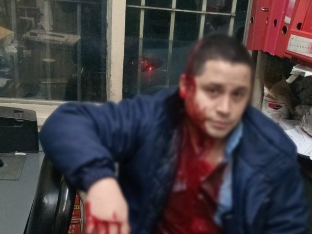 Paro de colectivos en el AMBA por la brutal agresión a un chofer: a qué línea afecta la medida de fuerza