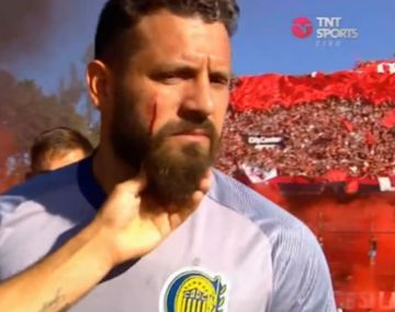Clima caliente en el clásico rosarino: Fatura Broun sufrió un corte en la cara