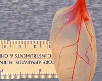 La espinaca en proceso de ser tejido muscular