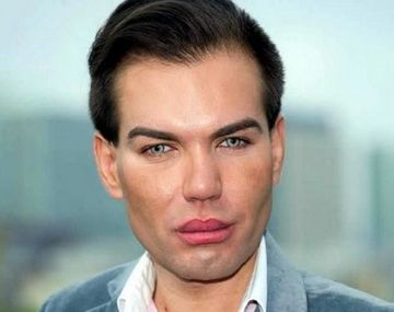 Gastó millones de dólares para ser como Ken