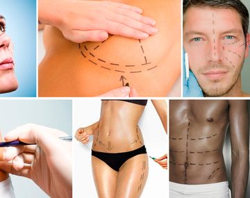 La piel que habito: el drama de las cirugías truchas afecta a cualquiera