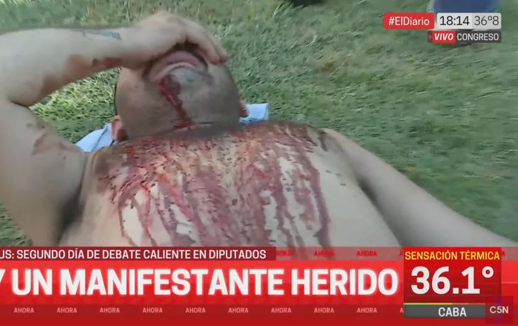 Tensión en el Congreso: un manifestante herido tras la represión policial