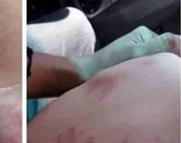 Las heridas que subrió el bebé