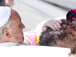 el papa bendijo a persona con rara enfermedad el papa bendijo a persona con rara enfermedad