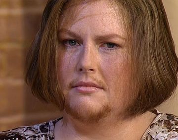 Una mujer se deja crecer la barba por una buena causa
