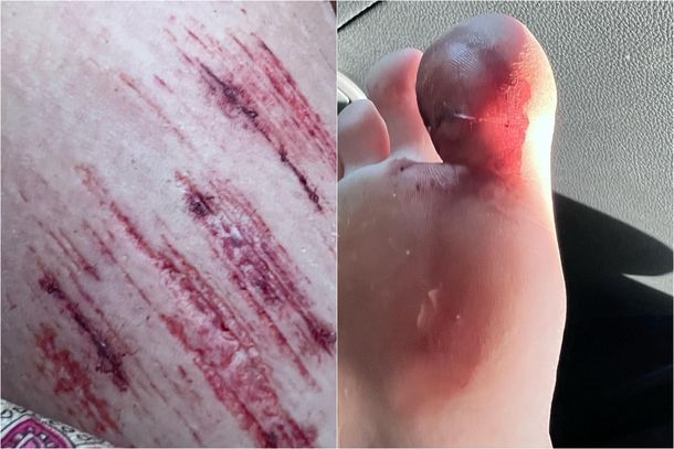 Las fotos del accidente de la China Suárez