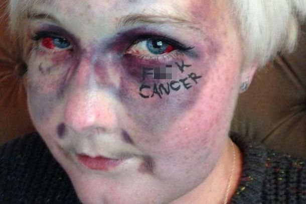 Se saca una impactante selfie para concientizar sobre la enfermedad: mirá la foto
