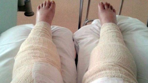 La mujer estuvo nueve días en coma