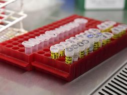 La vacuna contra el coronavirus podr&iacute;a estar lista antes del final de la pandemia