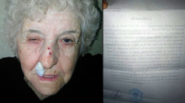 Hizo una denuncia por robo y en la comisaría le pidieron un... ¡examen ginecológico!