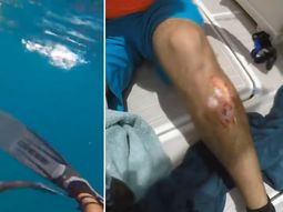 Un hombre sufrió el ataque de un tiburón en Key West