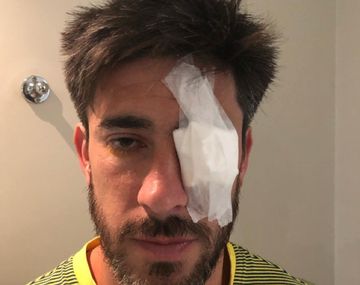 Habló Pablo Pérez: No se puede ir a una cancha donde no sabemos si podemos morir
