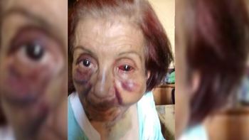 brutal golpiza a una anciana discapacitada en un geriatrico de mendoza brutal golpiza a una anciana discapacitada en un geriatrico de mendoza
