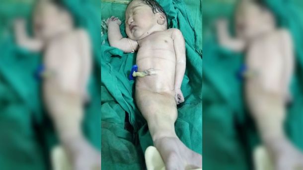 La triste historia de la sirenita que no logró sobrevivir tras su nacimiento