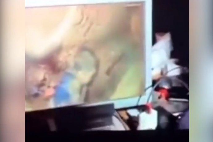 Intentan rescatar a un nene de 5 años que cayó en un pozo