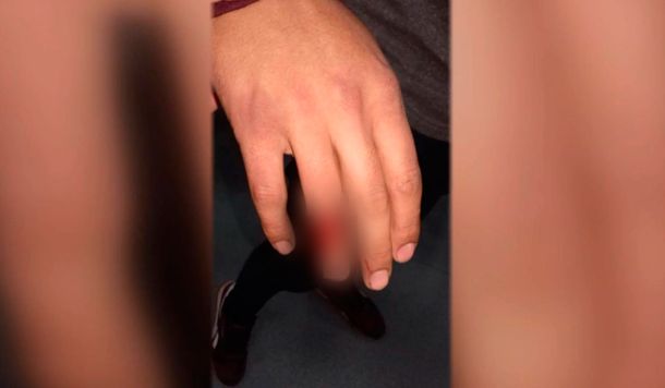 Atacaron a un colectivero en Villa Fiorito: le cortaron el cuello para robarle