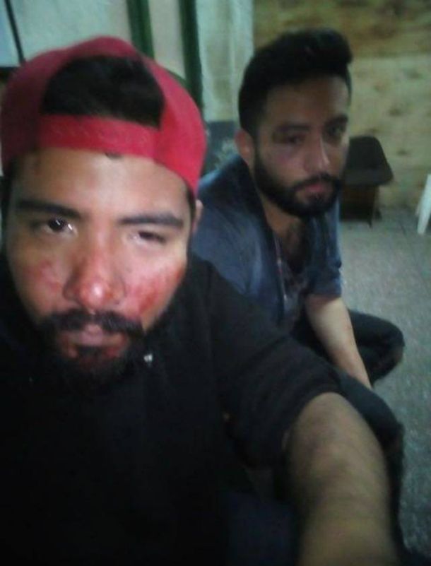 El ataque fue denunciado públicamente en Facebook por una amiga de la pareja