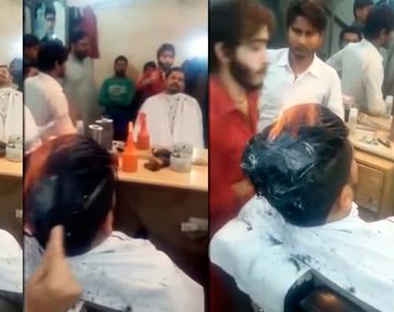Le cortan el pelo prendiéndoselo fuego
