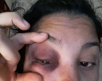 Ex mujer del jugador Mazzacote denunció violencia de género