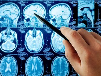 ¿Cómo es la ameba come cerebros que ya mató a un nene de 8 años en Argentina?