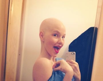 Una historia de superación: una modelo con cáncer se muestra sin pelo