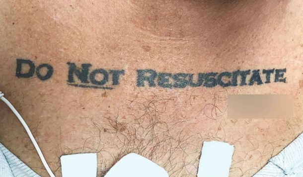 Miami: un hombre internado de urgencia tenía tatuado No resucitar