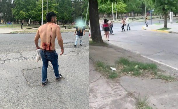 Cañuelas: el violento ataque por error de una patota contra cuatro jóvenes