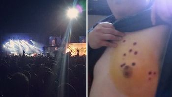 un periodista denuncio agresion policial en un recital de la renga un periodista denuncio agresion policial en un recital de la renga