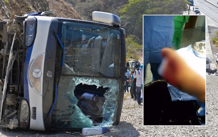 Impactante: Así quedó el pie de Toranzo después del accidente