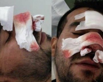 Santa Fe: patovicas le dieron una paliza a un joven en un boliche y lo dejaron inconsciente