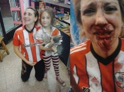una hincha de river fue salvajemente atacada por un fanatico de boca una hincha de river fue salvajemente atacada por un fanatico de boca