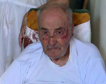 Terror en Villa Madero: torturan a un jubilado y casi lo electrocutan