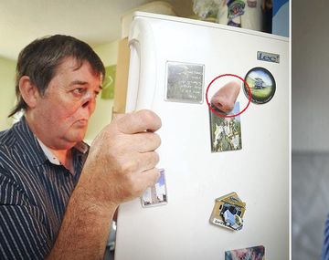 La increíble historia del hombre que respira sin  nariz