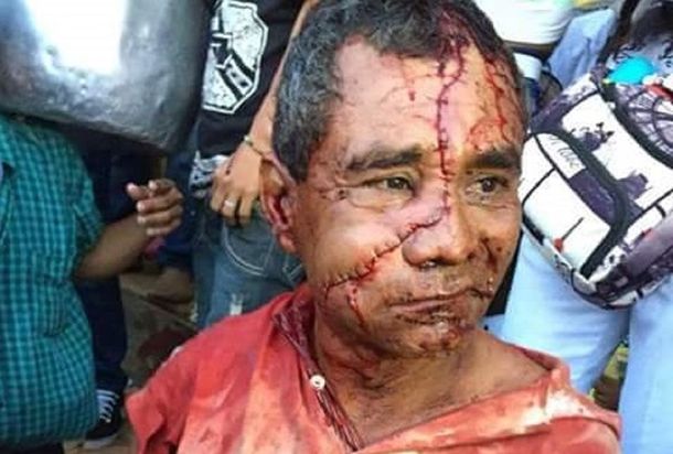 Un hombre recibió 50 puntos de sutura en su rostro después de ser atacado por un toro