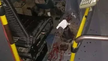 El colectivero se encuentra internado tras ser atacado en un robo El colectivero se encuentra internado tras ser atacado en un robo