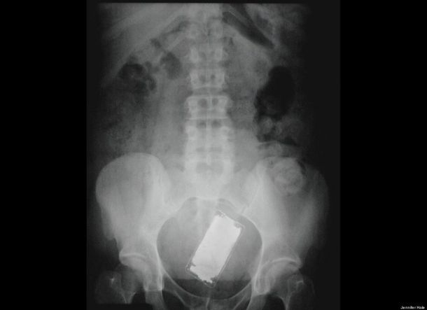 Rayos X Ipod
