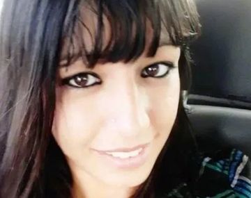 Murió la mujer que tenía el 85% de su cuerpo quemado en José C. Paz